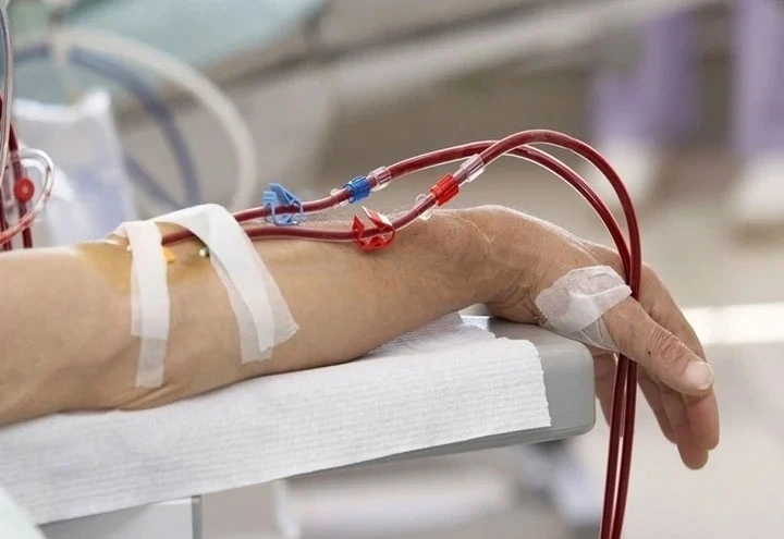 "Lọc m&aacute;u si&ecirc;u c&ocirc;ng nghệ" c&oacute; ngăn ngừa được đột quỵ?- Ảnh 1.