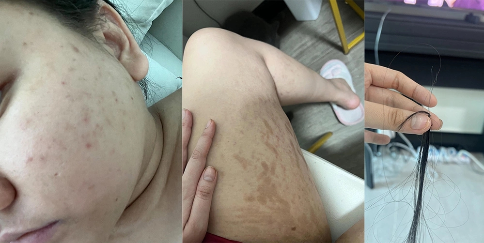 Tr&uacute;c Anh "Mắt biếc": T&ocirc;i sốc khi c&acirc;n nặng vượt mốc 80kg- Ảnh 3.
