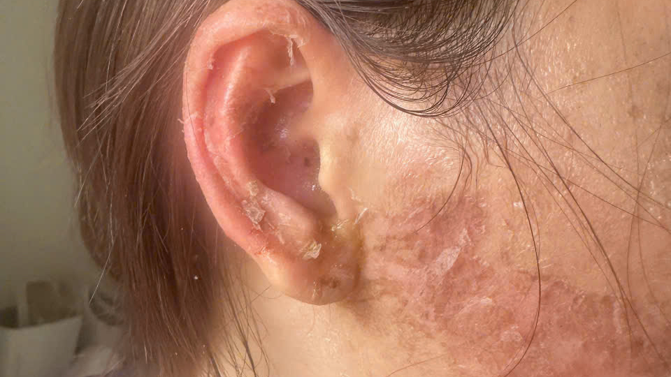 Điều tra vụ người phụ nữ ở C&agrave; Mau tố bị đ&aacute;nh đập, cắt t&oacute;c- Ảnh 1.