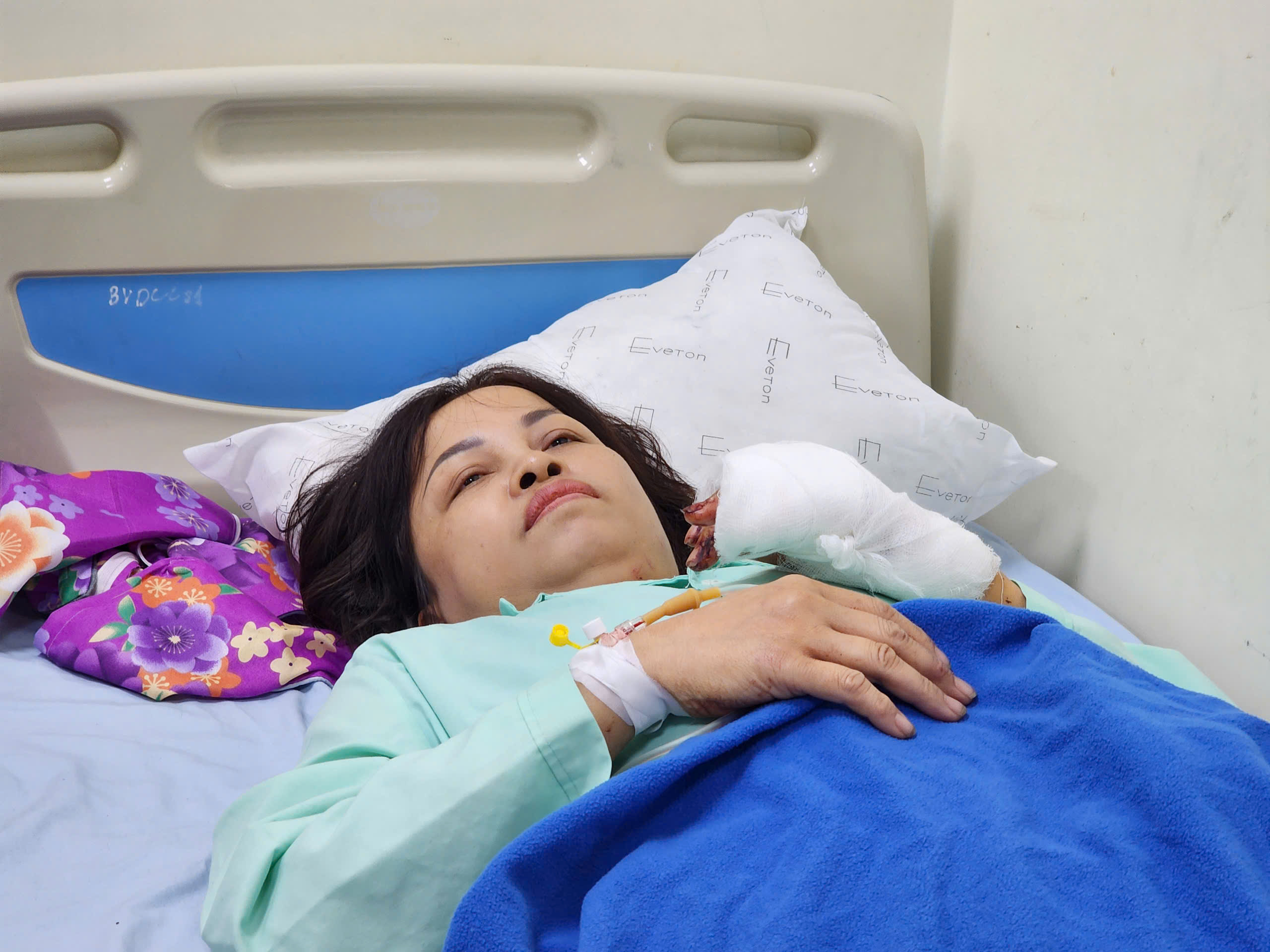 Nạn nhân vụ lật xe khách tại Tam Đảo kể lại giây phút kinh hoàng- Ảnh 1. Nạn nhân vụ lật xe khách tại Tam Đảo kể lại giây phút kinh hoàng- Ảnh 1.