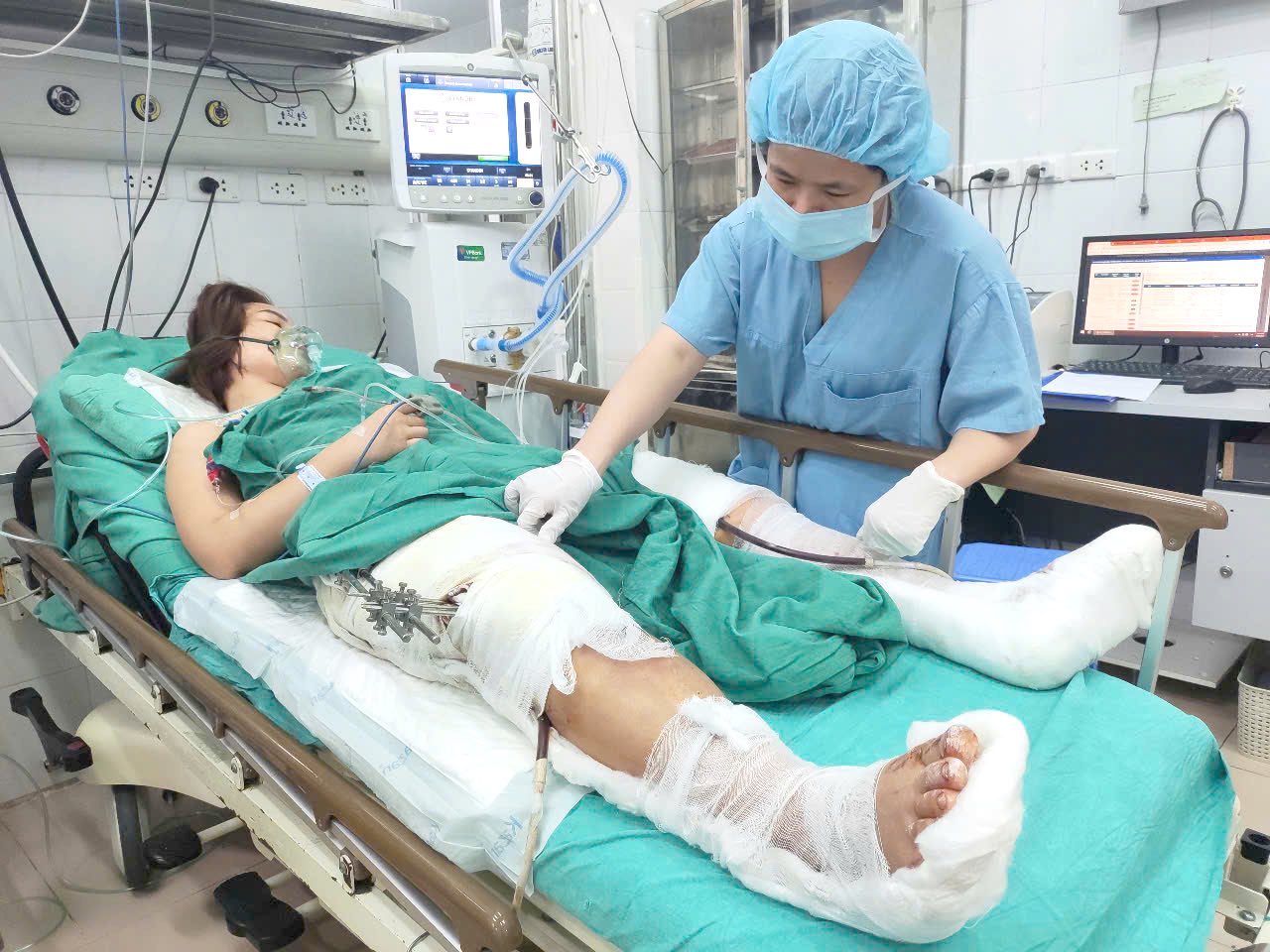 Sức khỏe 9 nạn nhân vụ lật xe khách ở Tam Đảo chuyển về BV Việt Đức hiện ra sao?- Ảnh 1. Sức khỏe 9 nạn nhân vụ lật xe khách ở Tam Đảo chuyển về BV Việt Đức hiện ra sao?- Ảnh 1.