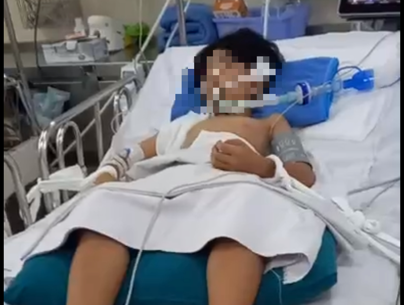 Bị nh&aacute;nh c&acirc;y rơi tr&uacute;ng đầu khi đang chờ đ&egrave;n đỏ, b&eacute; trai 10 tuổi ở TP.HCM nguy kịch- Ảnh 1.
