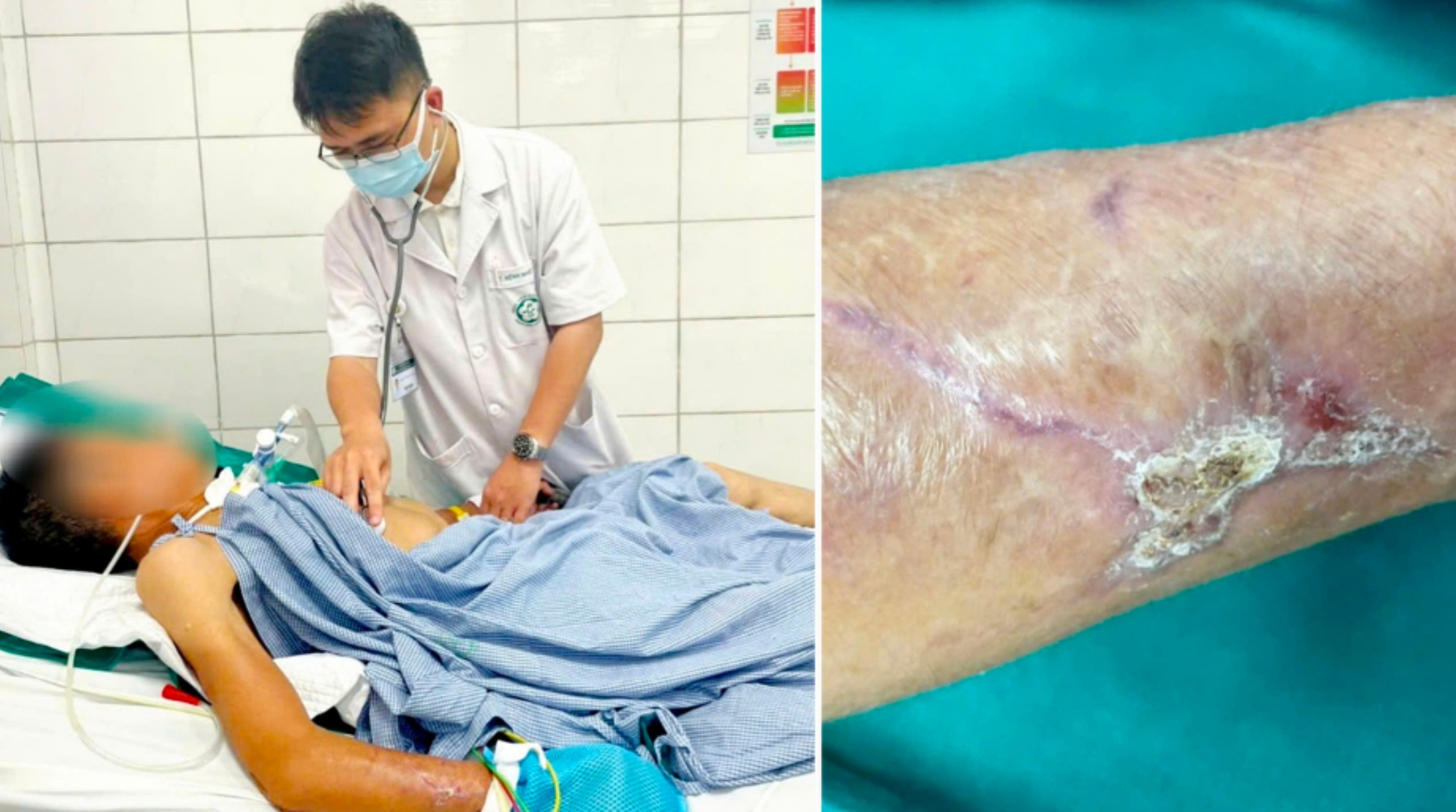 Cứng h&agrave;m, n&oacute;i yếu v&igrave; uốn v&aacute;n lại ngỡ đột quỵ n&atilde;o- Ảnh 1.