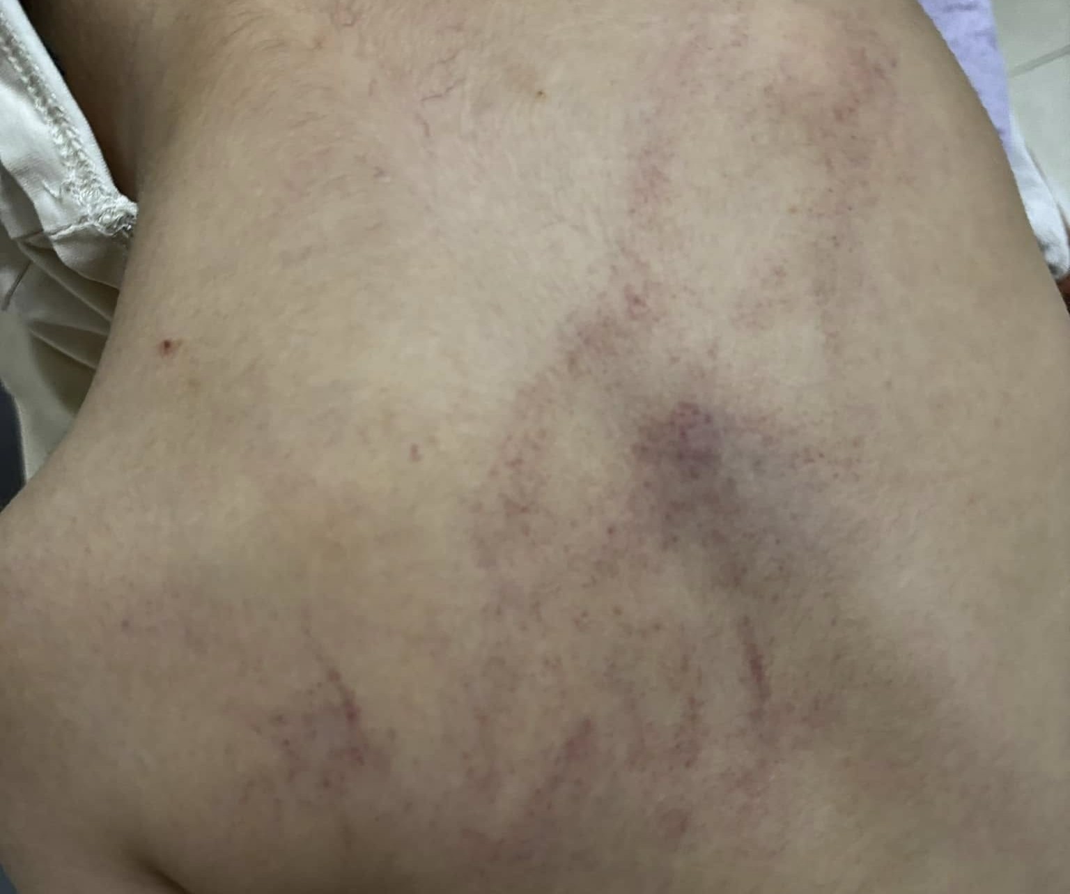 Tạm đ&igrave;nh chỉ c&ocirc;ng t&aacute;c 2 gi&aacute;o vi&ecirc;n nghi bạo h&agrave;nh trẻ ở trường Mầm non Gia Thụy- Ảnh 1.