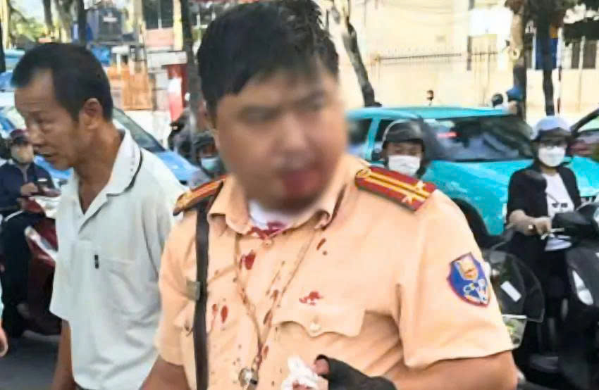 Xử l&yacute; va chạm giao th&ocirc;ng, trung t&aacute; c&ocirc;ng an bị một người nước ngo&agrave;i tấn c&ocirc;ng- Ảnh 1.