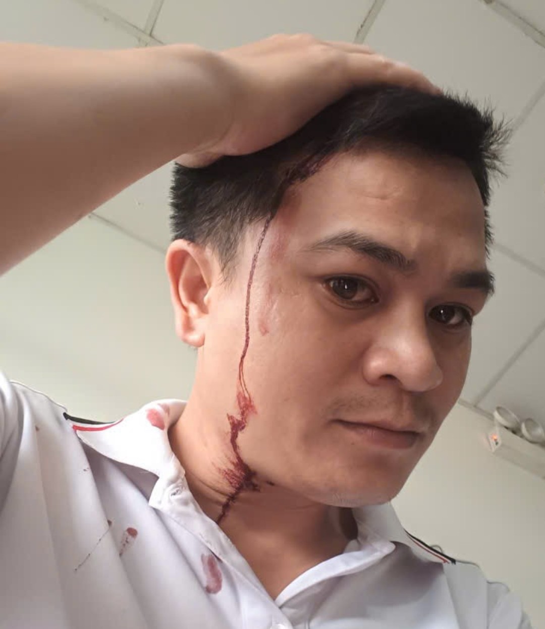 Người đ&agrave;n &ocirc;ng ở TP.HCM bị người lạ tấn c&ocirc;ng giữa đường phải nhập viện- Ảnh 1.