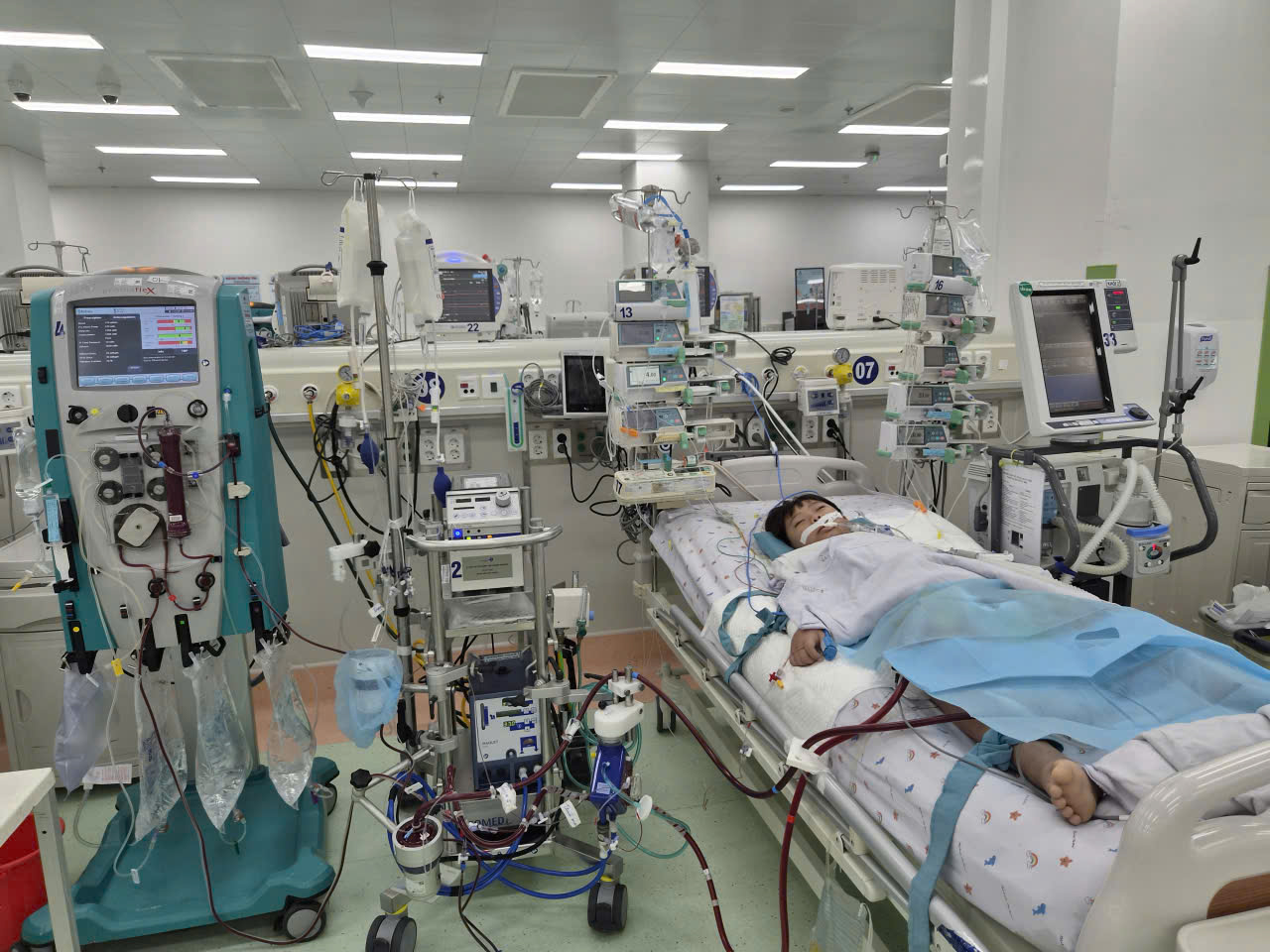 Cứu sống b&eacute; trai 7 tuổi nguy kịch do c&uacute;m A- Ảnh 1.