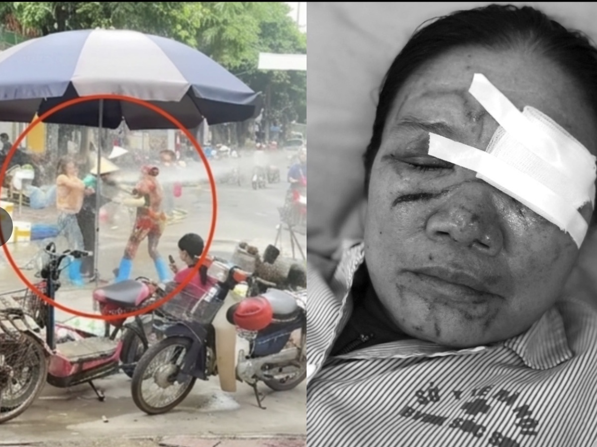 Ph&uacute; Thọ: Khởi tố người phụ nữ d&ugrave;ng v&ograve;i xịt rửa xe g&acirc;y thương t&iacute;ch cho người b&aacute;n rau - Ảnh 2.