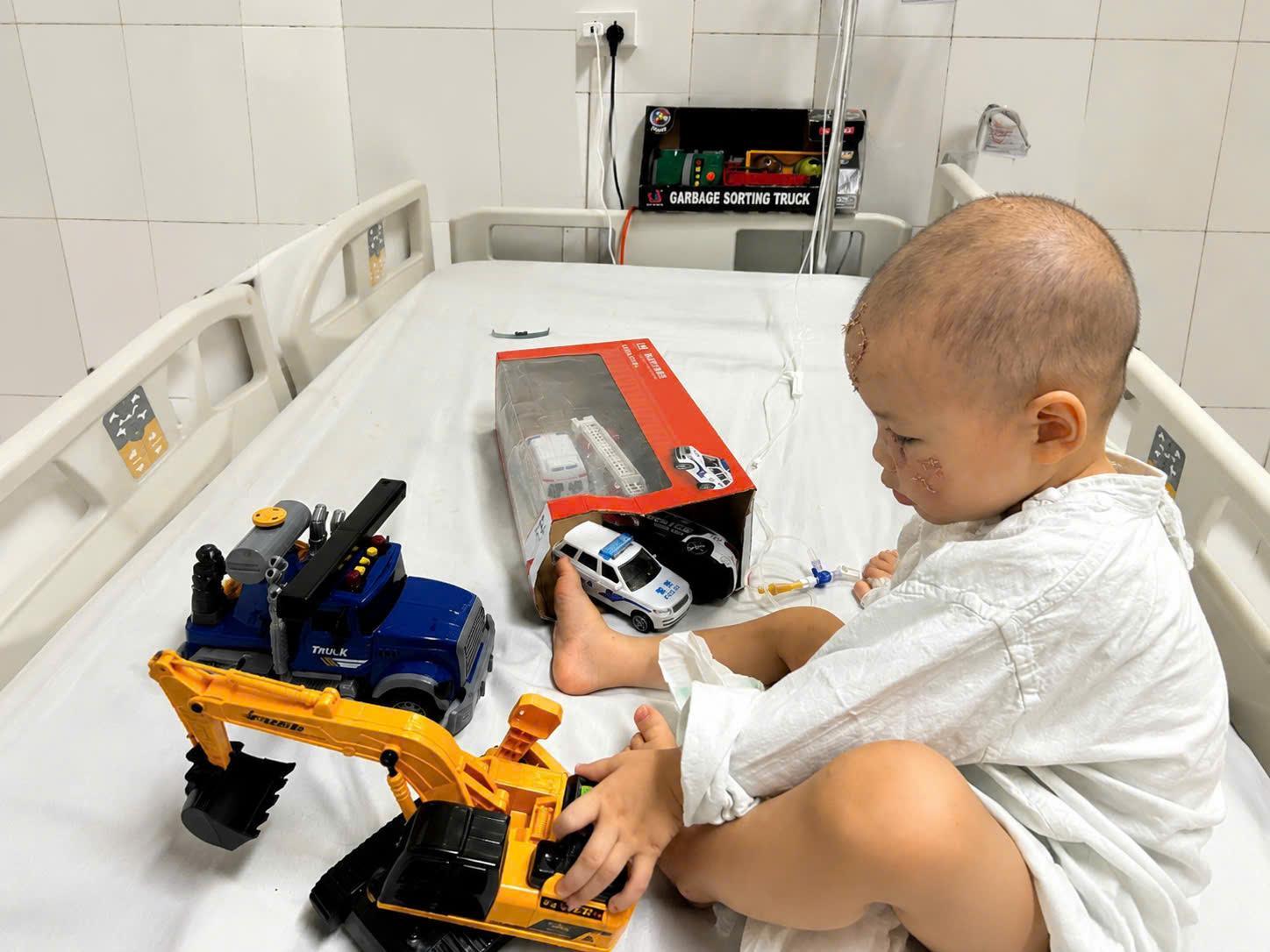 Phục hồi khu&ocirc;n mặt cho b&eacute; trai 26 th&aacute;ng tuổi bị ch&oacute; nh&agrave; cắn n&aacute;t v&ugrave;ng h&agrave;m mặt - Ảnh 3.