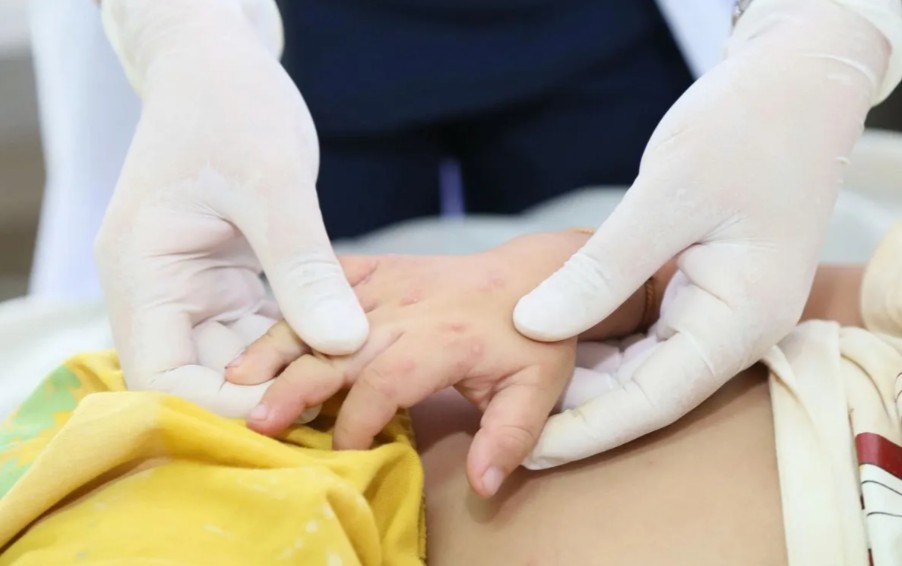 M&ugrave;a tựu trường, lưu &yacute; 4 nh&oacute;m bệnh c&oacute; nguy cơ tăng cao - Ảnh 2.