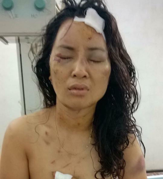 c&ocirc; gi&aacute;o tiểu học bị bạo h&agrave;nh