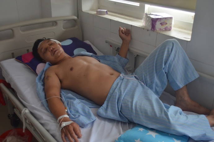 bị c&ocirc;n đồ d&ugrave;ng s&uacute;ng bắn v&agrave;o đầu