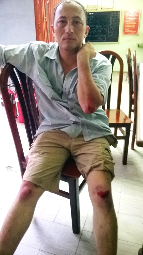 hiep-sy-minh-tien-cuop-bi-thuong-1