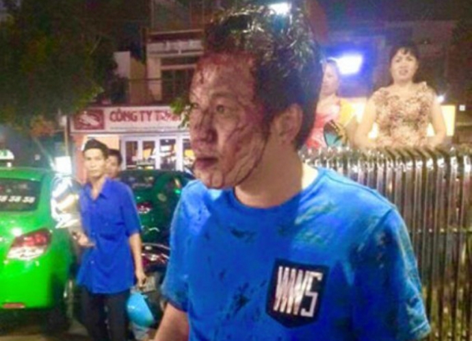 bao-ve-sieu-thi-danh-nguoi