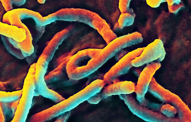 Virus Ebola qua k&iacute;nh hiển vi