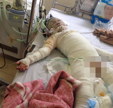 B&eacute; Tr&agrave; My l&uacute;c đang được cấp cứu tại Bệnh viện Sản nhi Nghệ An.