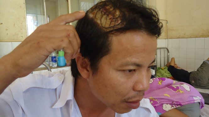 Nạn nh&acirc;n Đỗ Lưu (Ảnh: Tuổi trẻ)