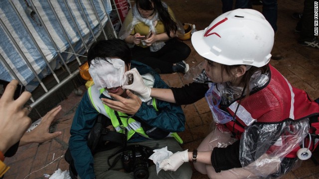 Một ph&oacute;ng vi&ecirc;n ảnh bị thương trong qu&aacute; tr&igrave;nh t&aacute;c nghiệp vụ đụng độ