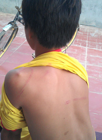 Em Hải bị một số học sinh trong trường d&ugrave;ng d&acirc;y điện v&agrave; ống tu&yacute;p đ&aacute;nh đập