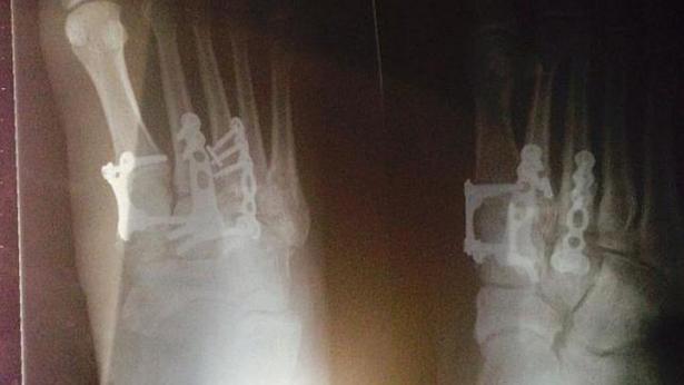 T&igrave;nh trạng thương tật của c&ocirc; Erin