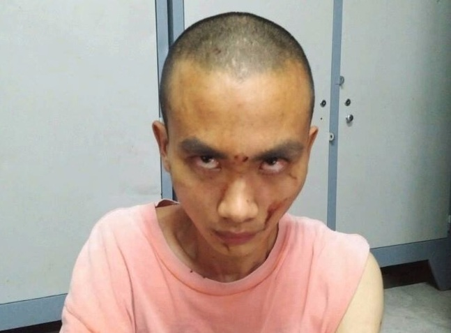 nghi-van-nha-su-gay-trong-an-su-dung-chat-kich-thi