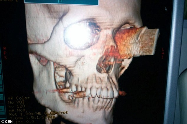 38B62E4900000578-0-image-a-26_1474623982106