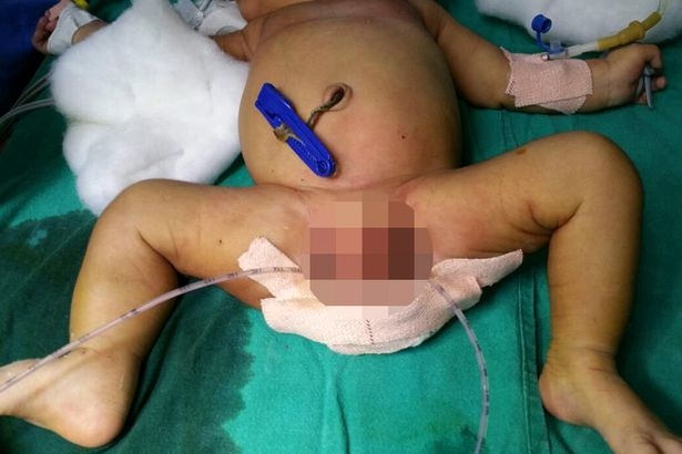 PAY-SWNS_BABY_LEG_02