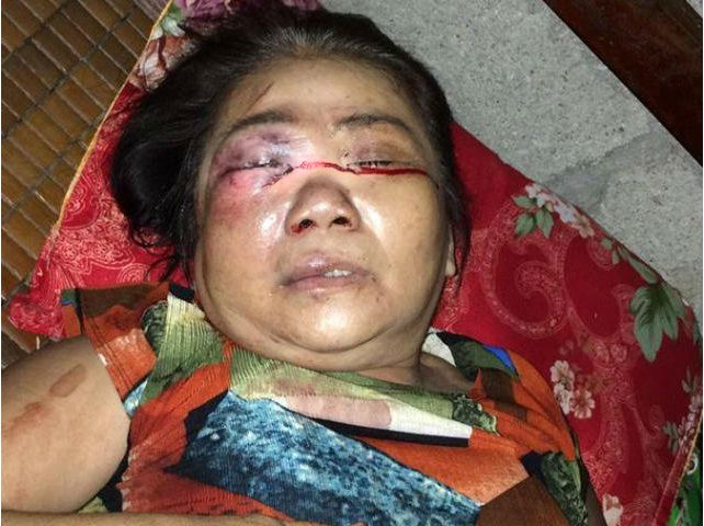 Hue-Truy-tim-nam-thanh-nien-hanh-hung-cu-ba-65-tuo