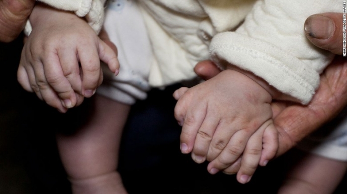 160504092757-restricted-02-polydactylism-exlarge-1