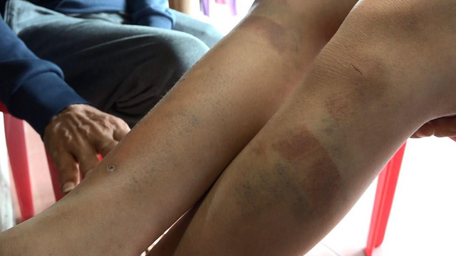 bao-hanh-6-1522465470235710202257