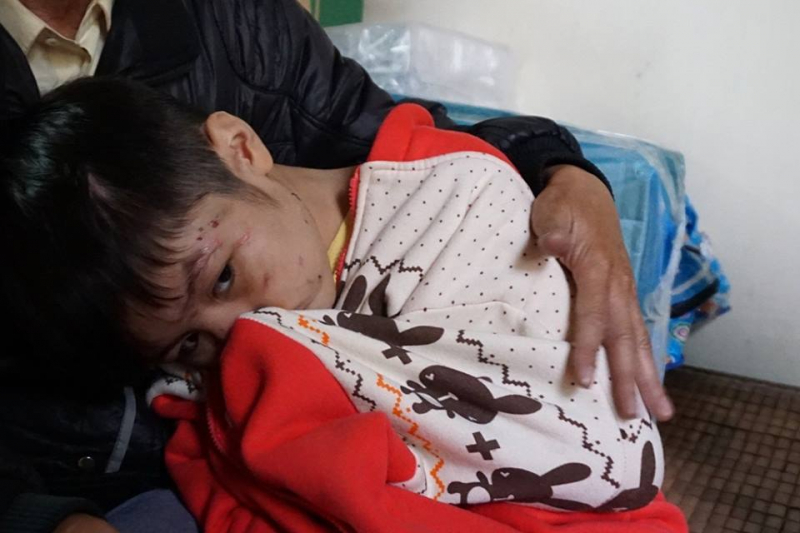 142649-be-trai-10-tuoi-bi-cha-bao-hanh