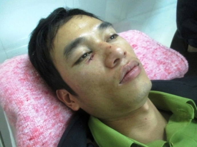 Khoi- to- vu- lam- tac- tan- cong- kiem- lam- bat-