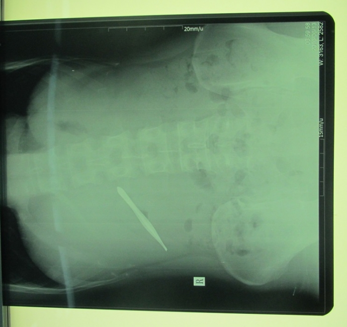 Noi- soi- lay- nhip- nho- rau- tam- tru- ca- thang