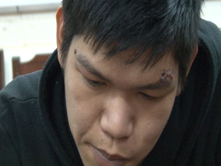 Bi- phat- hien- trom- do- con- nghien- lao- xe- ma