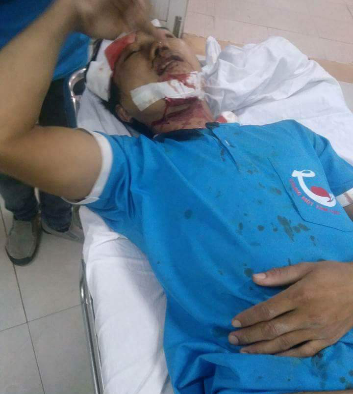 Đi l&agrave;m từ thiện bị thương nặng