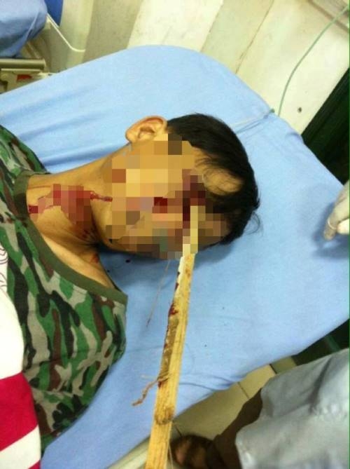 cay-dam-vao-mat-hinh-anh