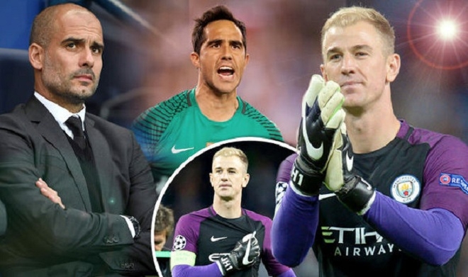 pep-joe-hart