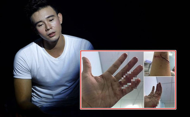 dong hung bi chu no chem