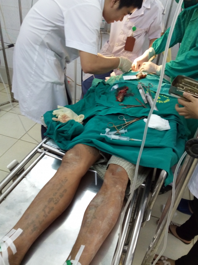 Thanh-Hoa-Nguy-kich-vi-di-danh-luoi-ca-ro-chui-vao