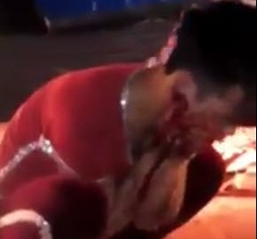 dien-vien-xiec-Ha-Nam-bi-cau-sau-can-nat-mat (2)