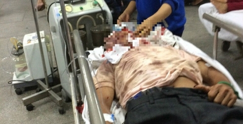 mua-dau-trau-bi-danh-nguy-kich-dspl (1)