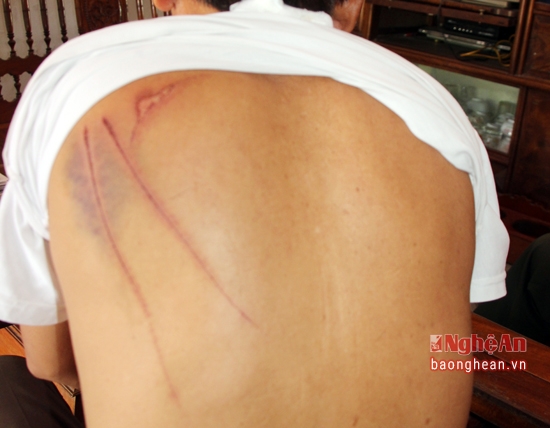 images1653777_ch_m_c_ng_an_2