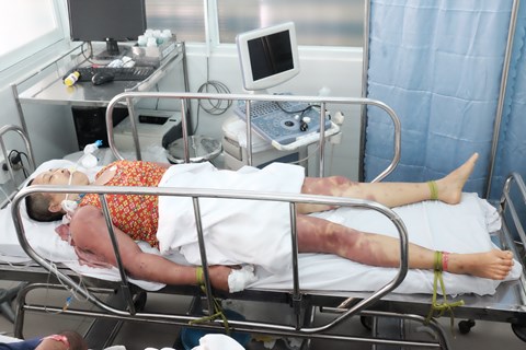 nghi-co-ta-2-chi-em-bi-thay-cung-danh-nguy-kich-hi