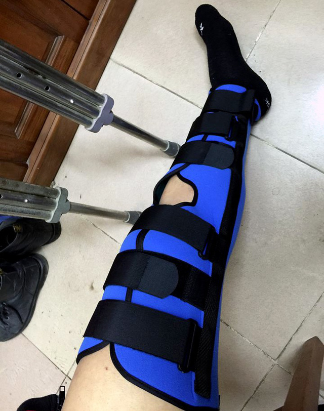 xe-dien2-1514115655968