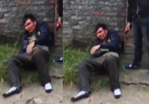 thanh-nien-trom-cho-bi-danh-chay-mau-dau