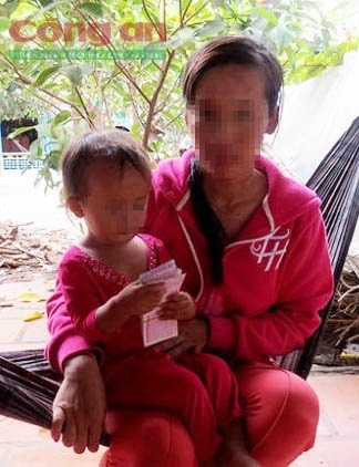 veso2congancomvn (1)