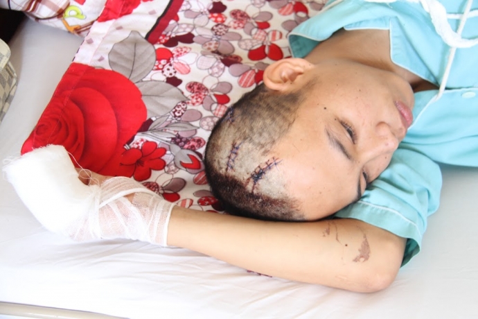 Hai-thieu-nien-bi-30-con-do-chem-trong-thuong-1