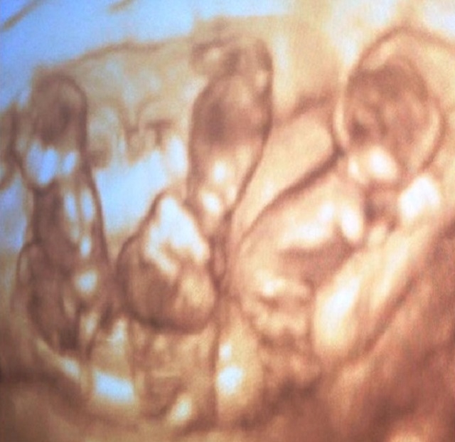 11069917_1617358925148850_7194291807695246000_n