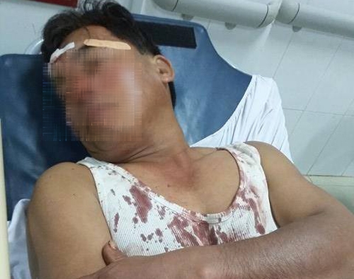 16603158_1875173726051336_412245915221100859_n