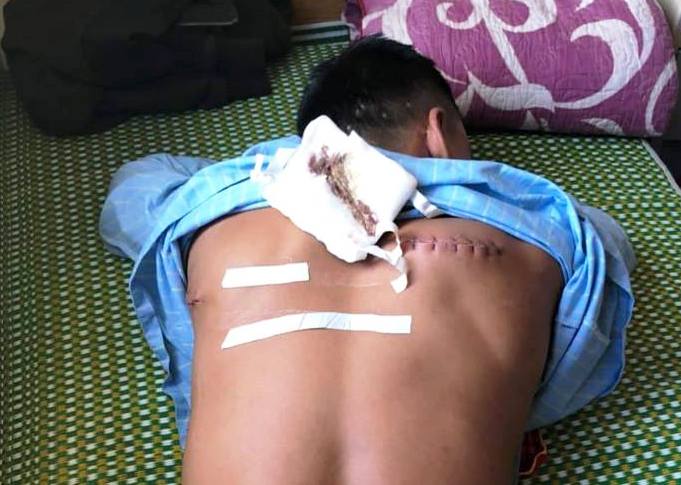 45261595_287375535236950_605377049120473088_n